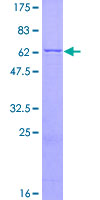 12.5% SDS-PAGE Stained with Coomassie Blue.